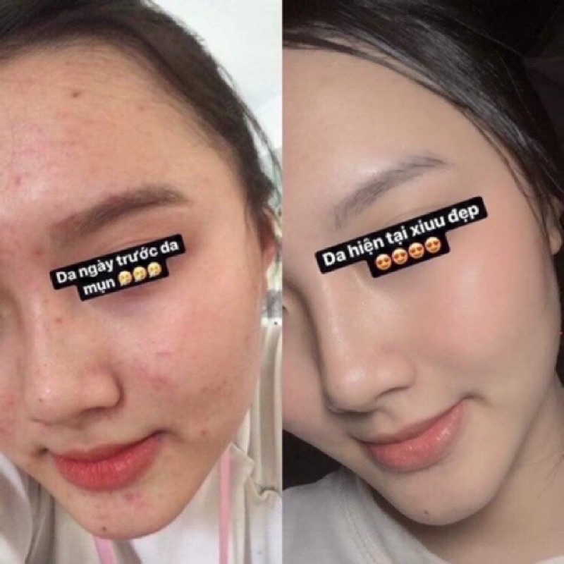 Serum Caramel Nhật Bản ( Check cod phiên bản mới ) | BigBuy360 - bigbuy360.vn