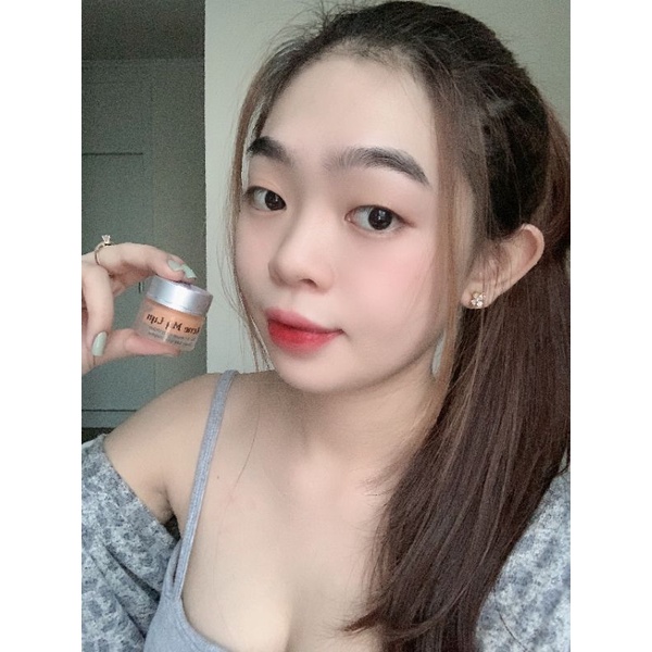 Acne Mỹ Lyn(vua tri tất cả các loại mun)