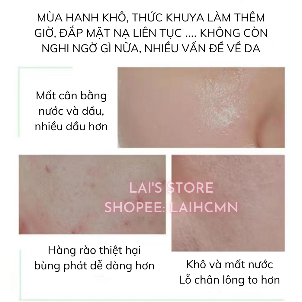Mặt Nạ Sủi Bọt Thải Độc GINBI  Chiết Xuất Rau Má Giảm Mụn, Thu Nhỏ Lỗ Chân Lông, Dưỡng Ẩm, Trắng Da, Mờ Thâm