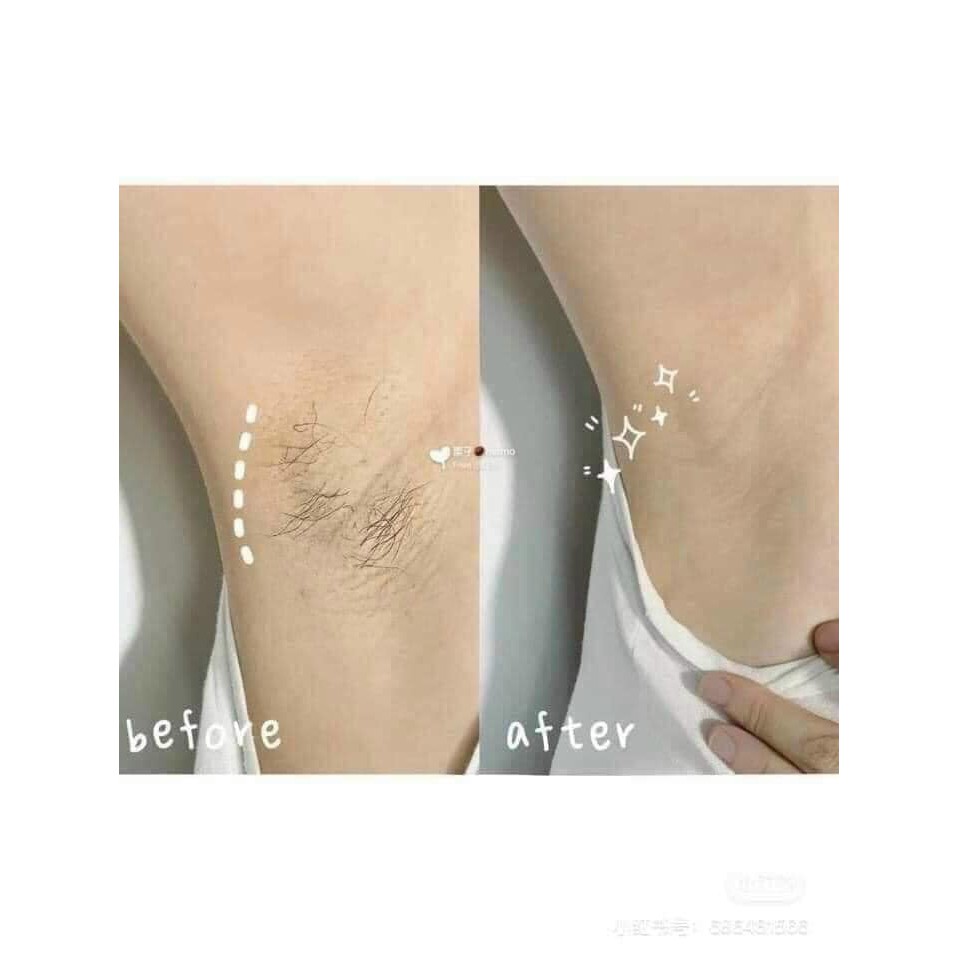 Kem tẩy lông VEET HAIR REMOVAL CREAM