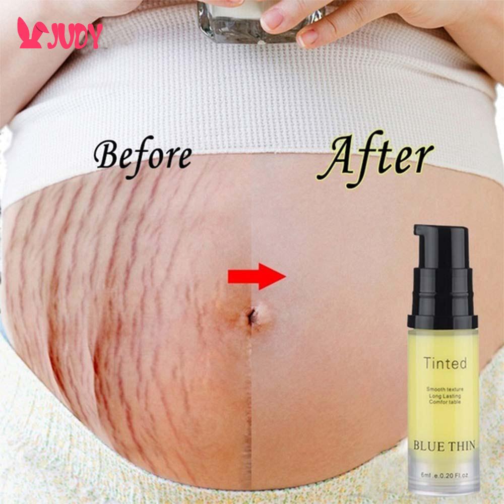 Effective Pregnancy Skin Care Postpartum Repair Cream 6ml Natural