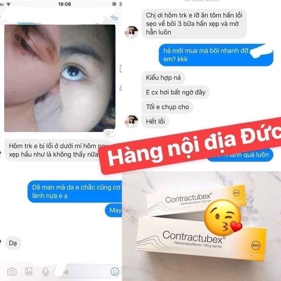 (Review) Kem dành cho vùng da sẹo Contractubex Đức 30g