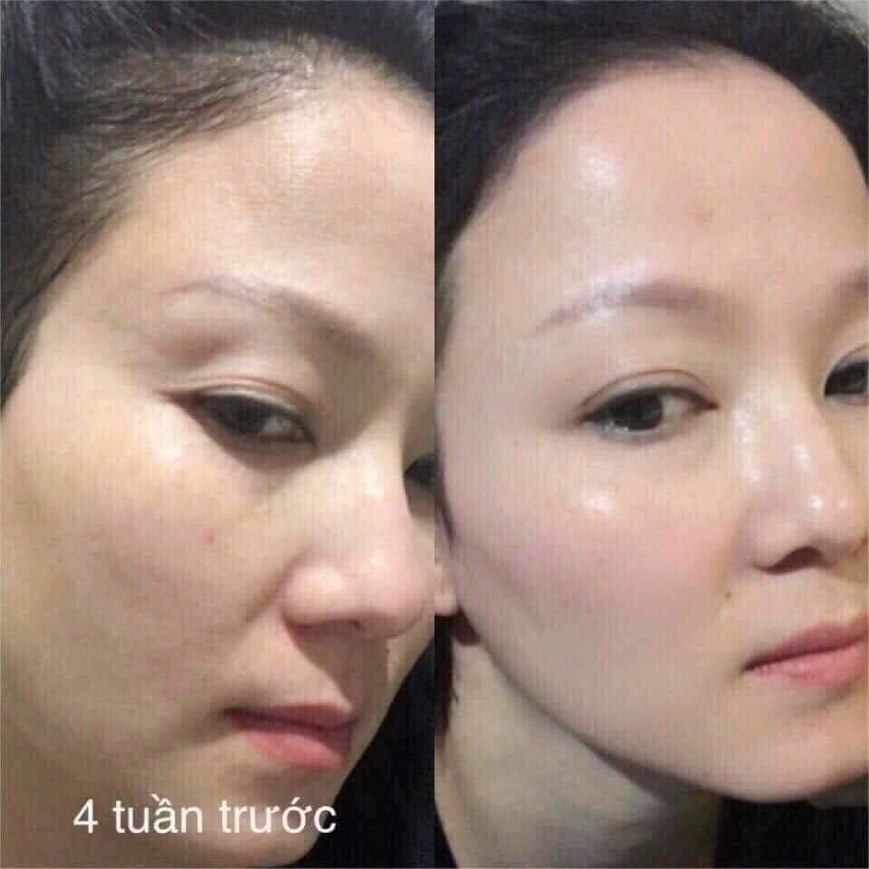 GÓI SERUM OHUI 777 CĂNG BÓNG DA, SE KHÍT LỖ CHÂN LÔNG