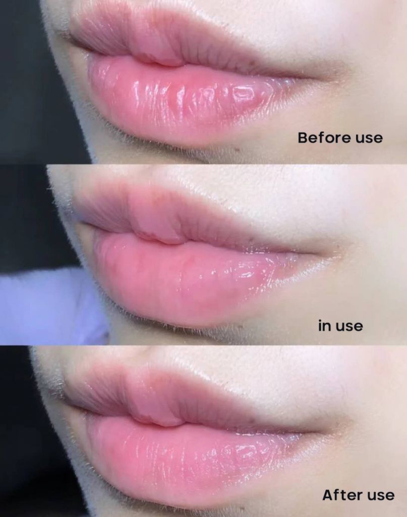 (Hàng Mới Về) Mặt Nạ Môi Mật Ong Dưỡng Ẩm Chống Nếp Nhăn | BigBuy360 - bigbuy360.vn