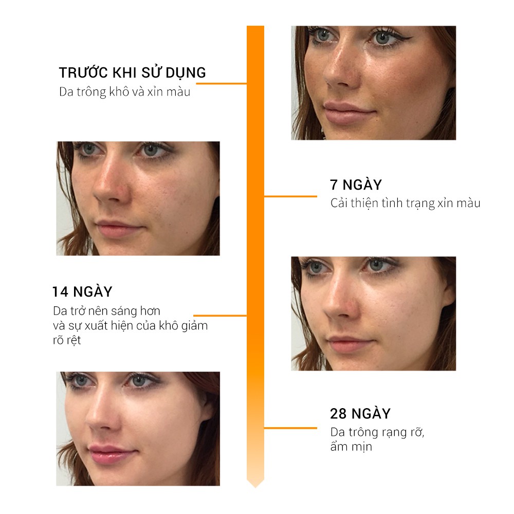  Serum BREYLEE Chứa Vitamin C Hỗ Trợ Dưỡng Trắng Làn Da Hiệu Quả Cao 17ml | BigBuy360 - bigbuy360.vn