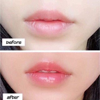 Son dưỡng môi carmex