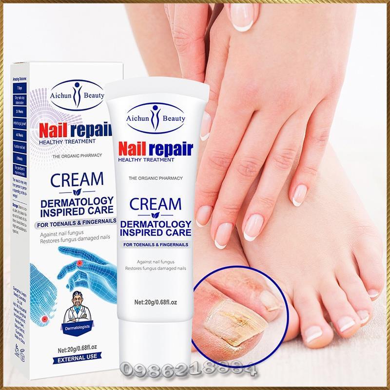 Kem nấm móng Aichun Nail Repair Cream phục hồi nấm móng tay móng chân A4719