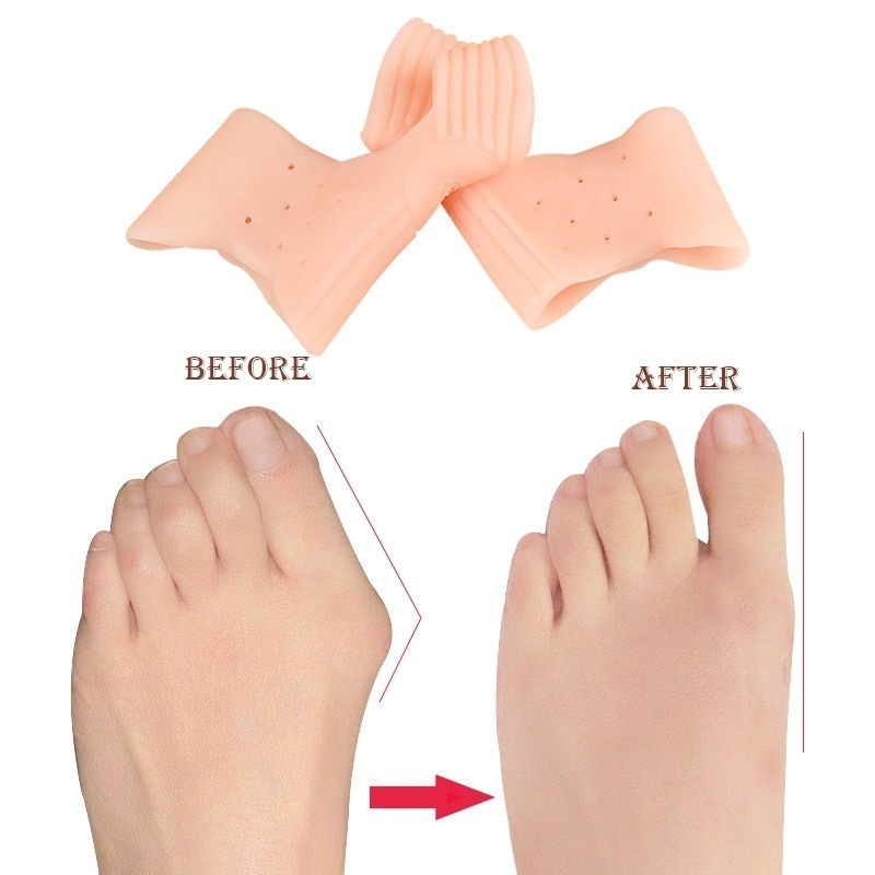 [Hàng mới về] Vỏ bọc nẹp chỉnh hình ngón chân cái siêu mỏng chăm sóc sức khỏe