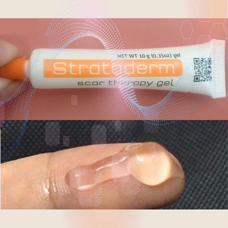 STRATADERM® - Gel Hỗ Trợ Làm Liền, Mờ Sẹo Lồi, Sẹo Xấu - Tuýp 5/10/20gr