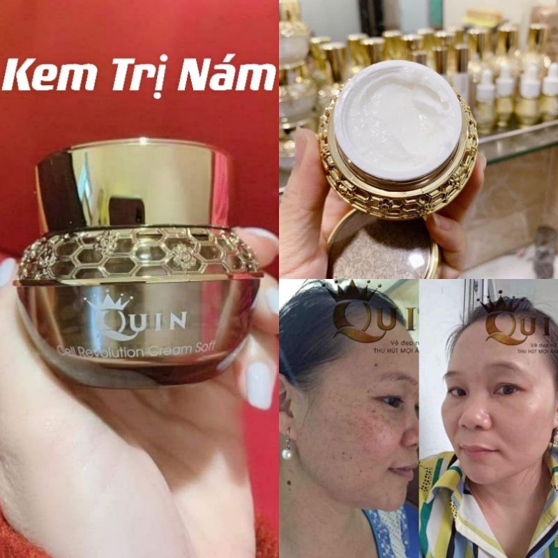 Kem mờ nám Quin phiên bản mới 2021