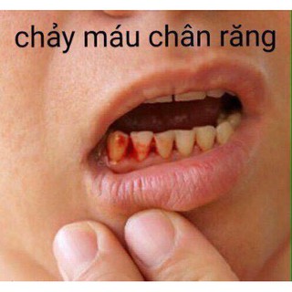 Nước ngậm súc miệng