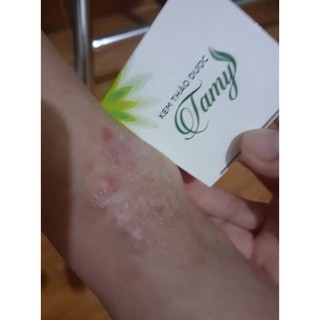 KEM THẢO DƯỢC TAMY (MUA 2 TẶNG 1)