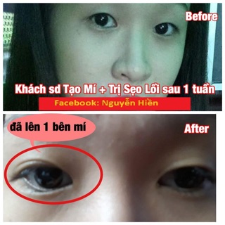 [ FREE SHIP ] Tinh chất tạo mắt 2 mí Pháp