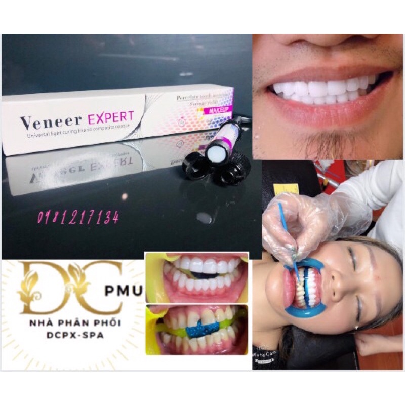 PHỦ BÓNG RĂNG TITAN