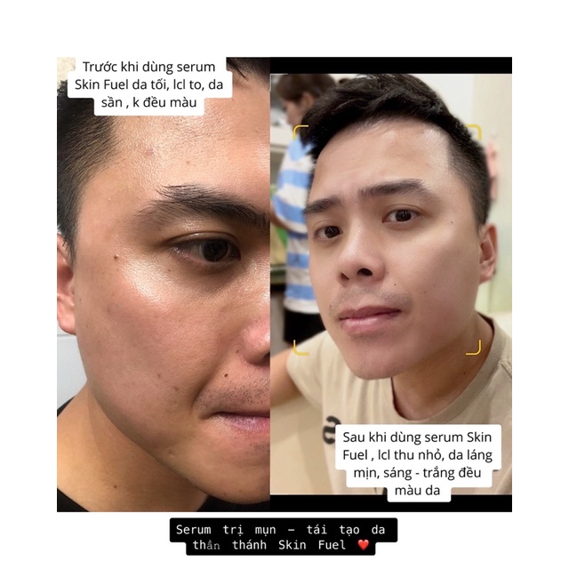 Serum tái tạo làn da Skin Fuel | BigBuy360 - bigbuy360.vn