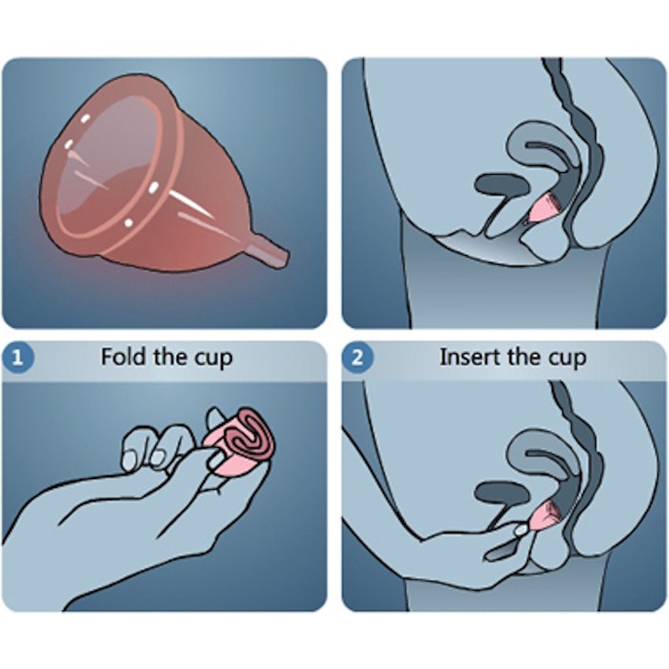 Cốc Nguyệt San Pháp Pharma Cup