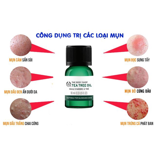 Tinh Dầu Tràm Trà Chấm Mụn, Kháng Khuẩn, Giảm Mụn The Body Shop Tea Tree Oil