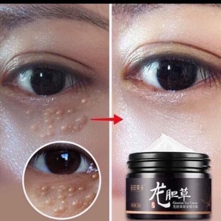 Kem mụn thịt và quầng thâm mắt