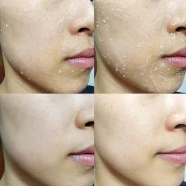 Tẩy Tế Bào Chết Dạng Gel Pink Scrub Cho Da Mặt, Body,Từ Dầu Cám Gạo, Nha Đam Sạch bã Nhờn, Hết Mụn 150g-Hà Mi mart | BigBuy360 - bigbuy360.vn