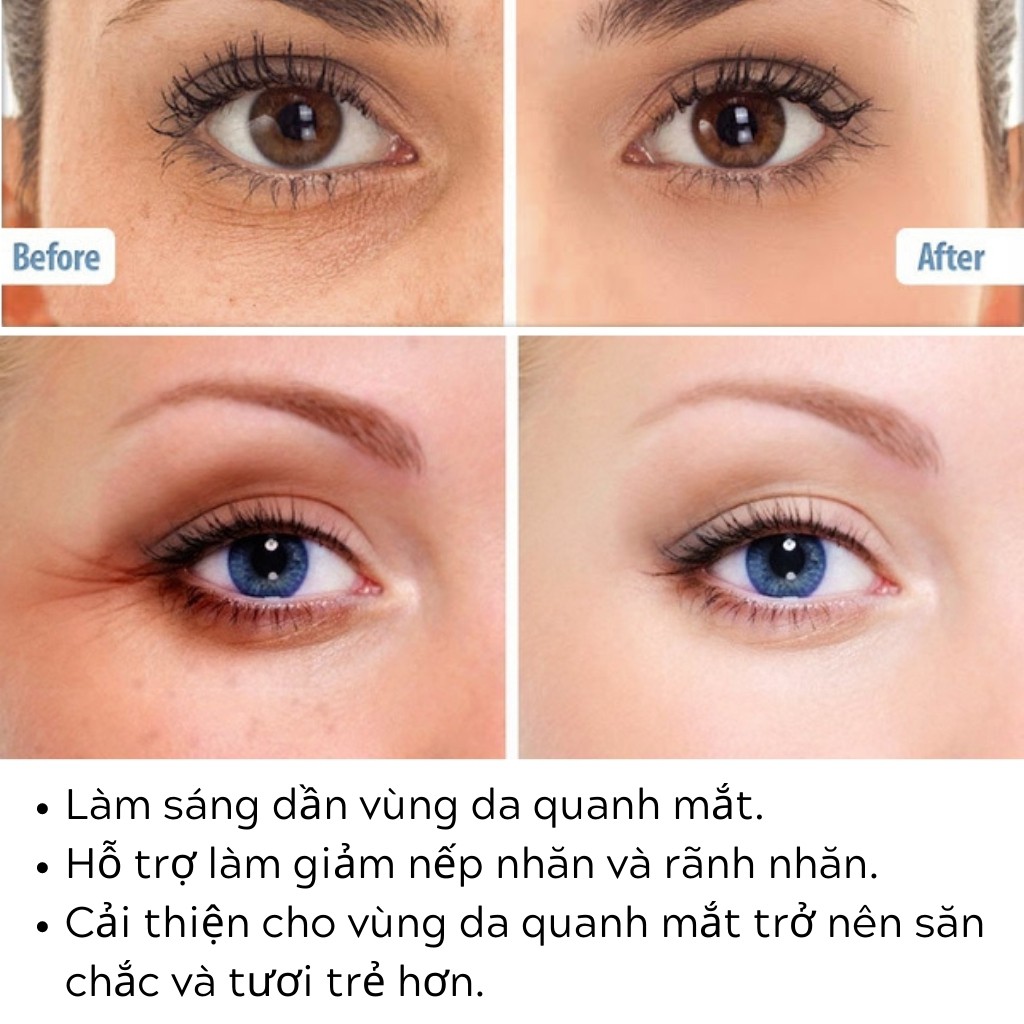 Kem Mắt Balance Nọc Rắn Máu Rồng Gold Collagen Chống Lão Hóa (15ml) | BigBuy360 - bigbuy360.vn