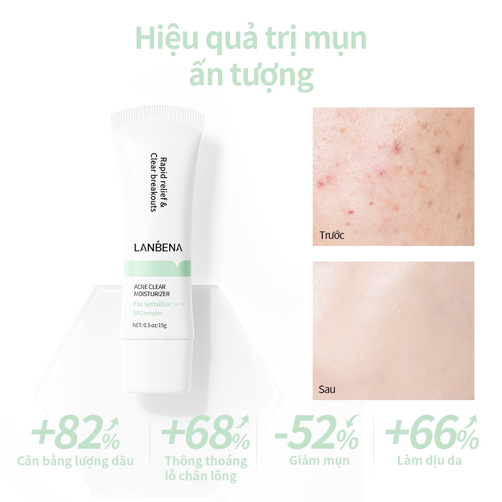 Set mỹ phẩm LANBENA sữa rửa mặt tạo bọt 100ml kem dưỡng ẩm giảm mụn 15g serum kiềm dầu 15ml nhanh chóng hiệu quả