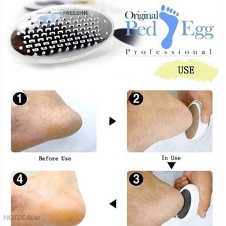 Dụng cụ trà gót chân Ped Egg ko còn da chết
