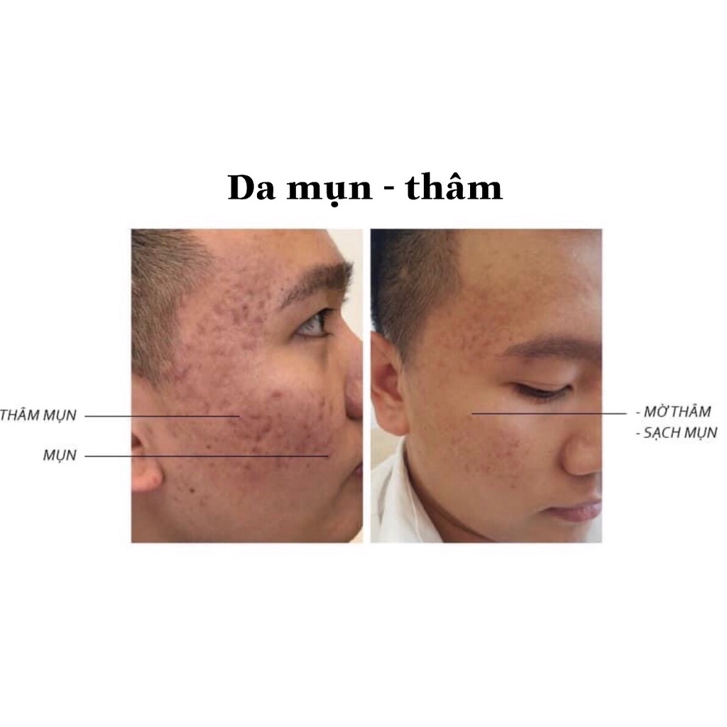 MUA 1 TẶNG 1 - Peel da trẻ hóa Tảo Canxi Doctor One giảm mụn nám, thâm sạm, căng bóng trắng sáng da