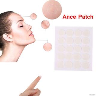 Hộp 40 miếng dán mụn trong suốt chất lượng tốt