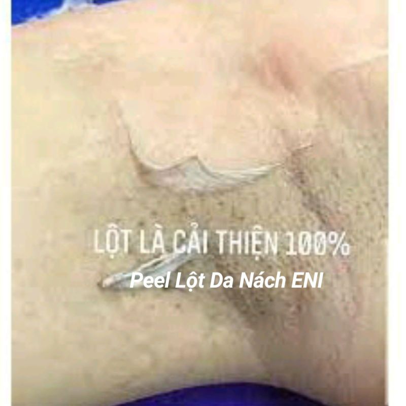 Peel Lột Nách Hết Thâm Sạm Trắng Da