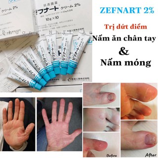 Kem Nấm Móng ZEFNART 2% - Kem Bôi Nước Ăn Chân Tay Nhật Bản - encosmetics