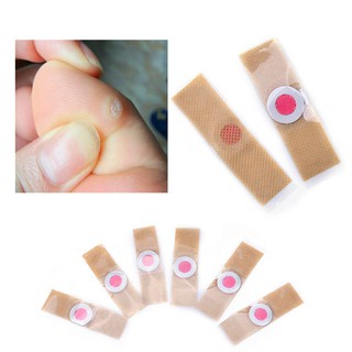 Miếng dán giảm mụn cóc hộp 6 miếng dán  dễ dàng loại bỏ mụn, mụn cơm an toàn hiệu quả - Loki store