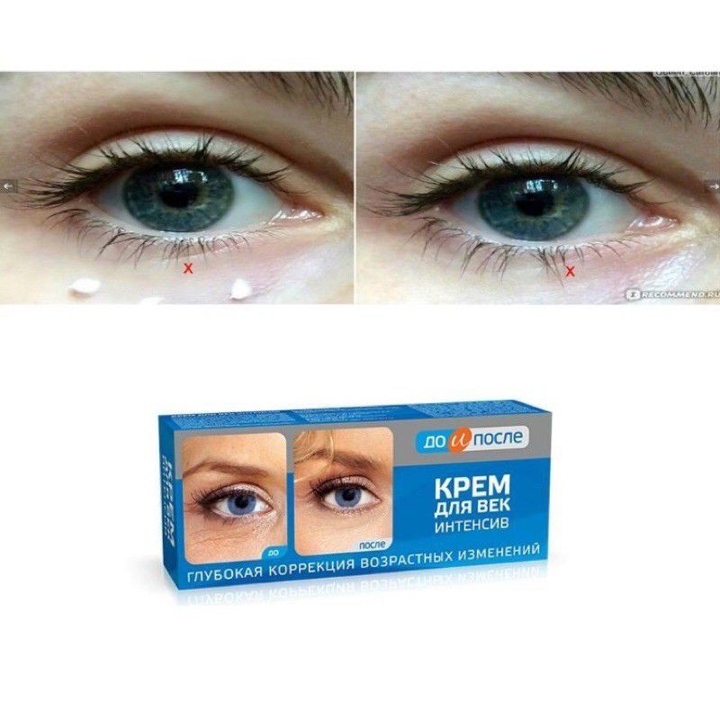 Kem giảm nhăn và chân chim mắt Kpem