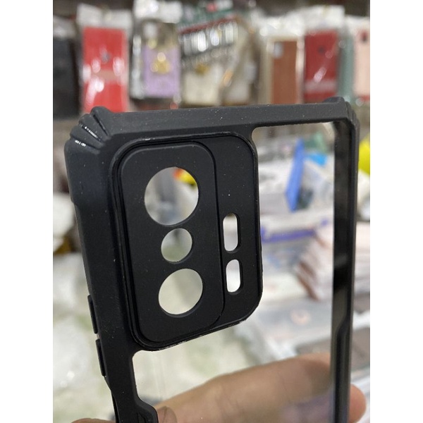Ốp lưng Xiaomi Mi 11T / 11T Pro 5G viền dẻo đen lưng nhám mờ bảo vệ camera