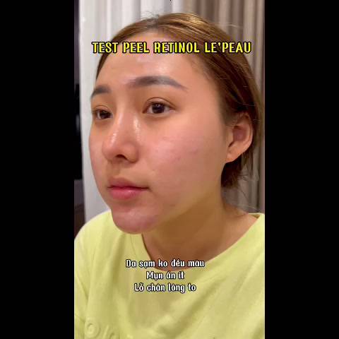 Peel Da Retinol Vi Tảo 10ml, Tinh Chất Tái Tạo Da Sinh Học Căng Bóng Chính Hãng, Tặng Kèm Serum B5 Phục Hồi - LE'PEAU | BigBuy360 - bigbuy360.vn