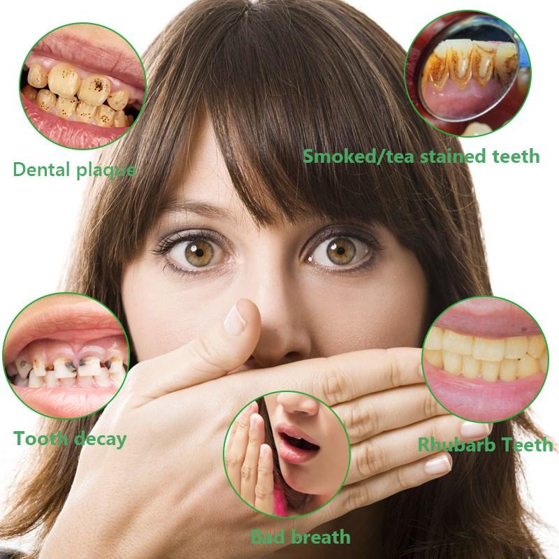 Bút Chăm Sóc Răng Miệng Sáng Tạo Hiệu Quả Dễ Mang Theo Giúp Làm Trắng Răng
