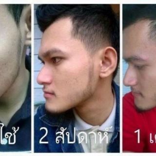 SNOR(Thailand)serum mọc tóc,râu
