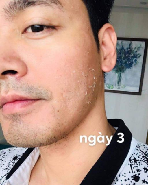 (TẶNG ĐÈN NẾN) Tảo Bỉ 2B Bio Peeling - Thay Da Sinh Học, Nâng Cơ, Trẻ Hóa | BigBuy360 - bigbuy360.vn