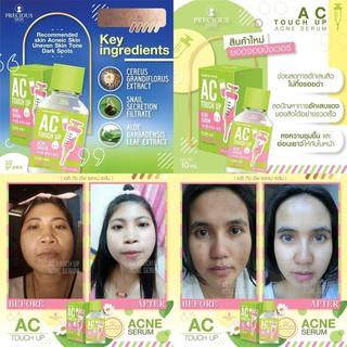 SERUM MỤN AC 𝐓𝐎𝐔𝐂𝐇 UP 𝐀𝐂𝐍𝐄 𝐒𝐄𝐑𝐔𝐌 𝐏𝐑𝐄𝐂𝐈𝐎𝐔𝐒 𝐒𝐊𝐈𝐍 THAILAND 10ML