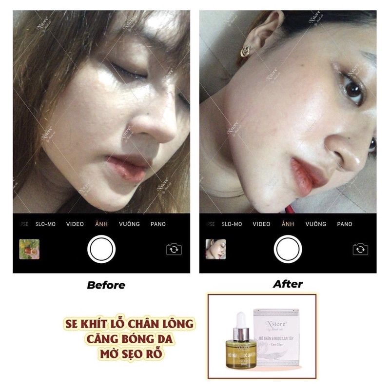 Mỡ Trăn Ngọc Lan Tây Nstore triệt lông mặt, nách, bikini, tay chân,...dưỡng da, chấm mụn 30ml