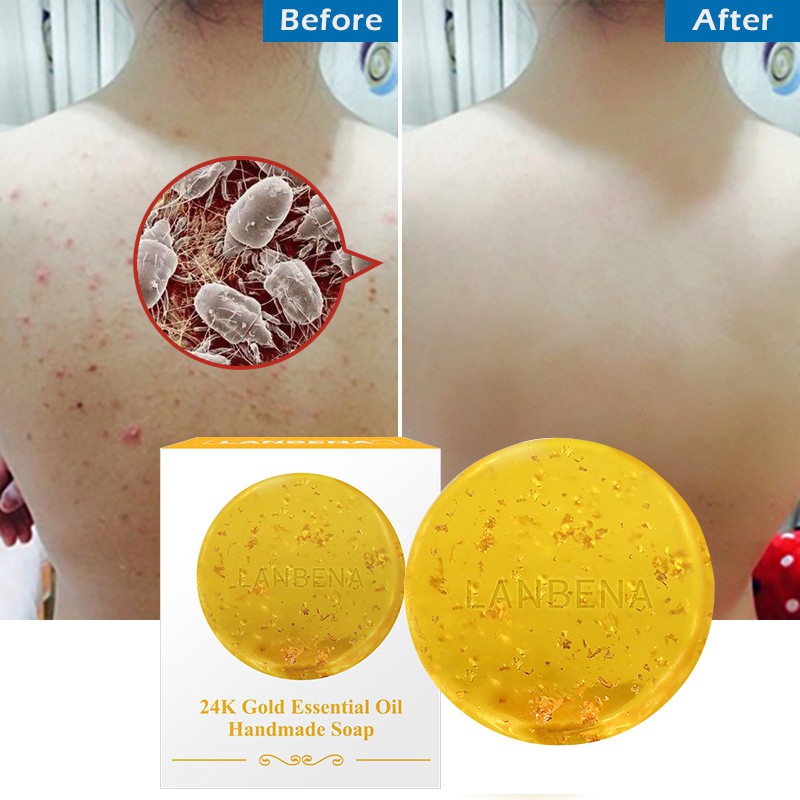 Xà Phòng Làm Trắng Da Tinh Chất Vàng 24K Lanbena 40g