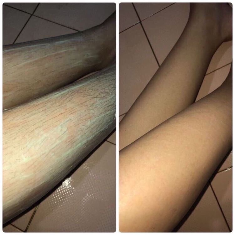Kem tẩy lông IWAX 150ml triệt lông tại nhà an toàn cho mọi loại da