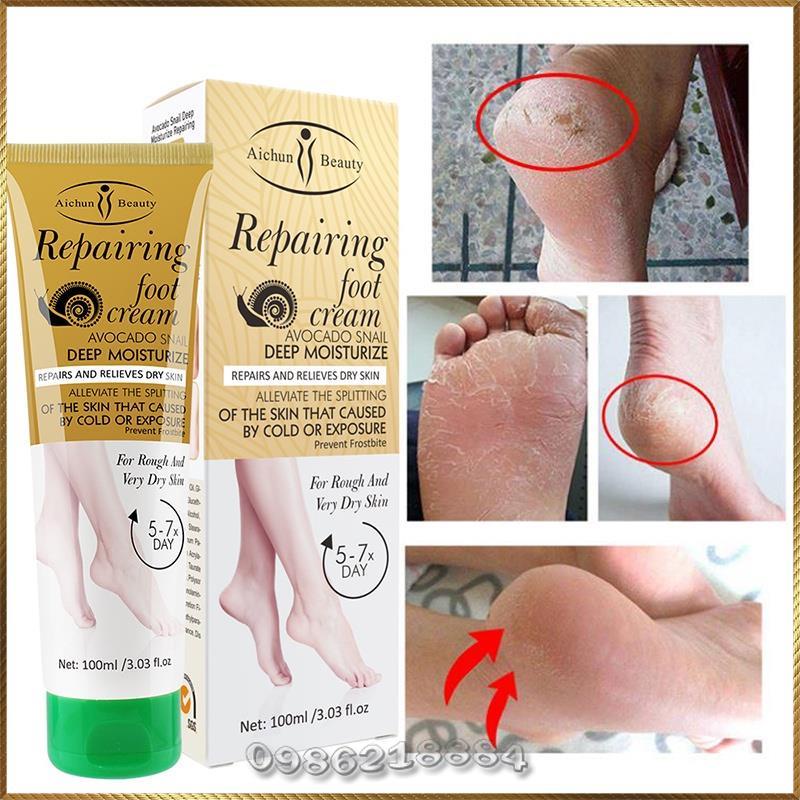 Kem dưỡng chống nứt nẻ da chân Aichun Repairing Foot Cream giúp mềm mịn da A0971