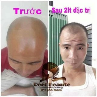 Túi lọc gội đầu thiên nhiên