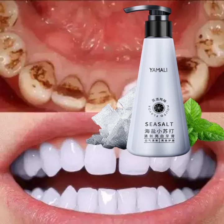 Làm trắng răng kem chống hôi miệng loại bỏ cao răng khói vết ố làm trắng răng nhanh chóng hơi thở thơm tho
