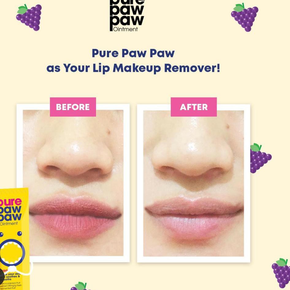 (Hàng Mới Về) Móng Vuốt Lipbalm - 25gr Chất Lượng Cao