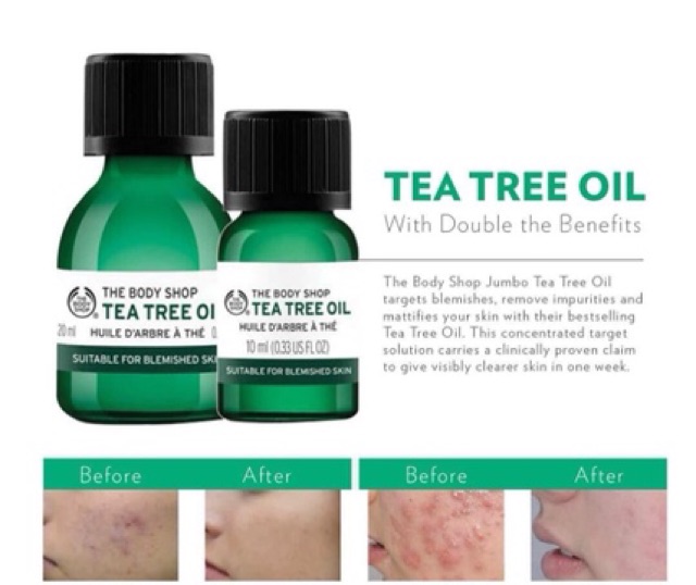 Tinh Dầu Tràm Trà Tea Tree Oil The Body Shop 10ml