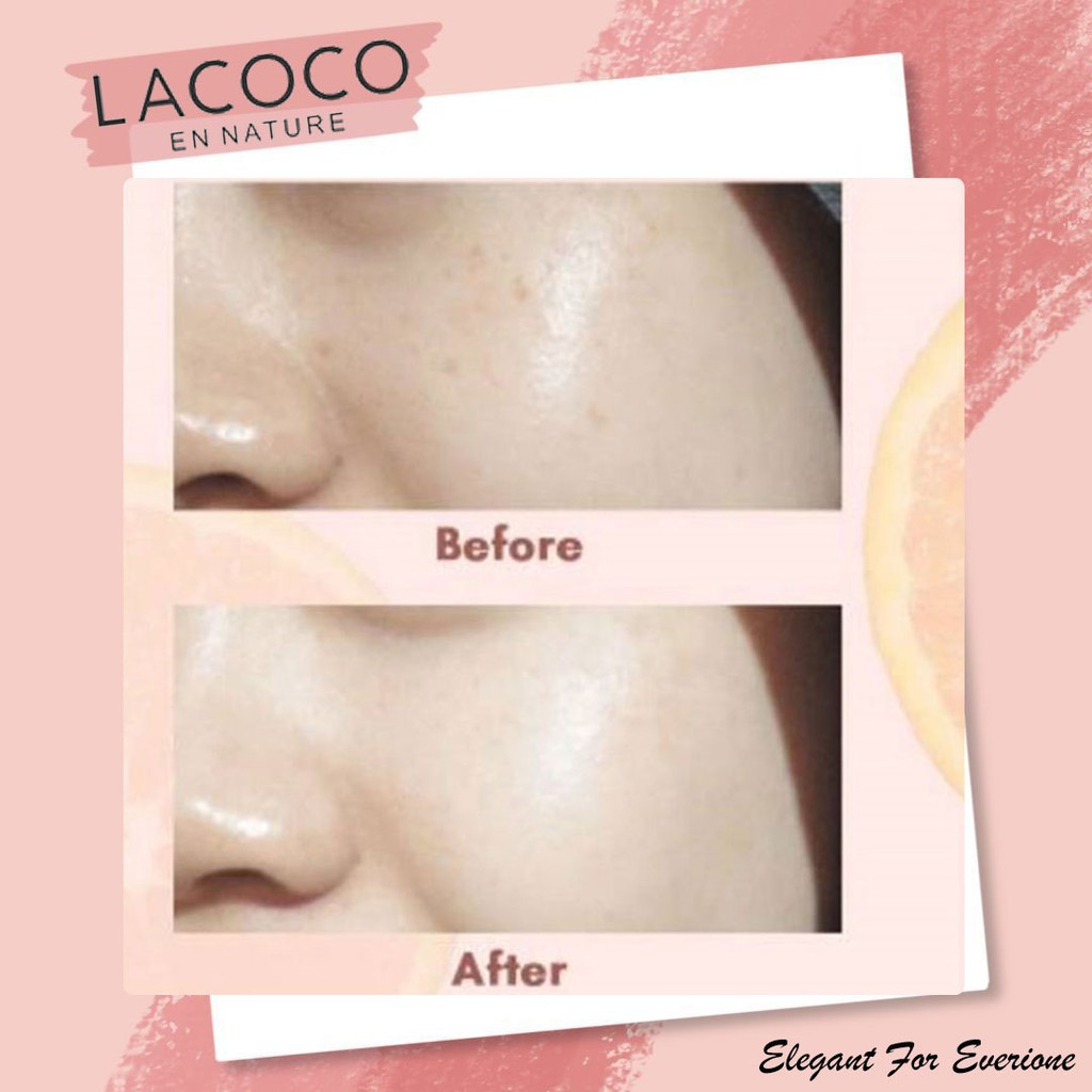 Tinh Chất Dưỡng Ẩm Làm Sáng Da Chống Lão Hóa Lacoco | BigBuy360 - bigbuy360.vn