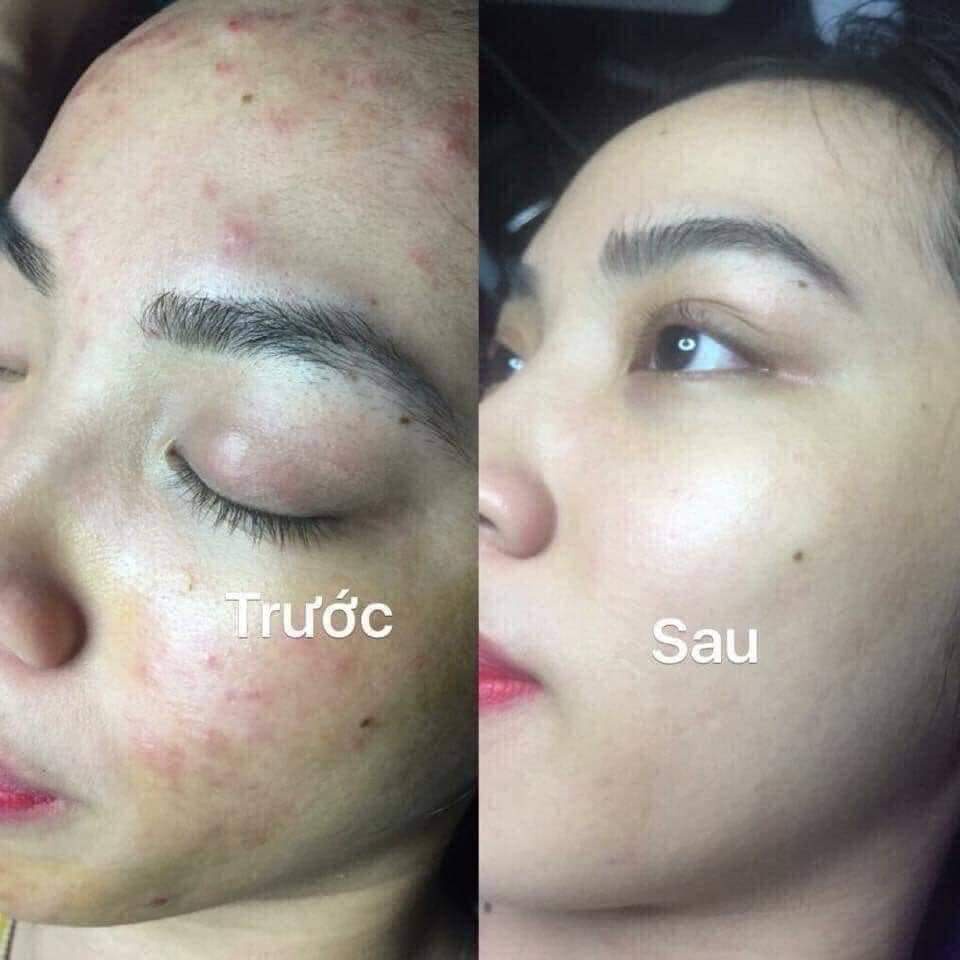 - Sữa rửa mặt Hoa Đào Thinggroup