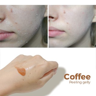 Gel Tẩy Tế Bào Chết Cà Phê