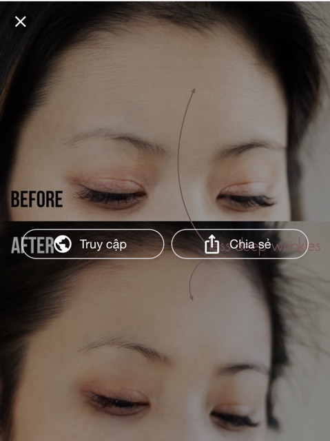 Kem Chống nhăn Neutrogena Rapid Wrinkle Repair Regenerating Cream